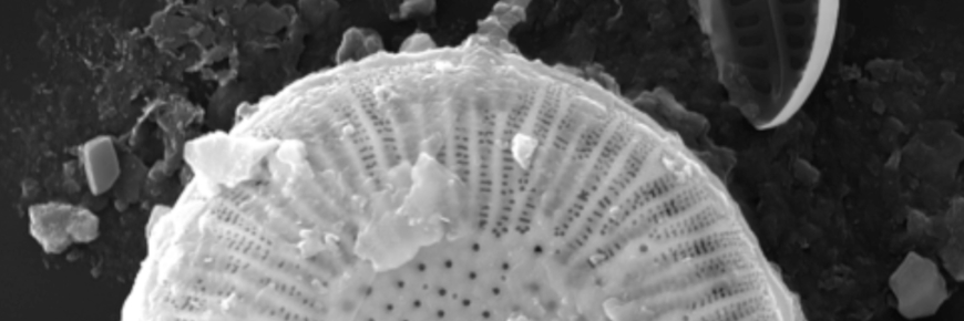 Créature unicellulaire vue au microscope.