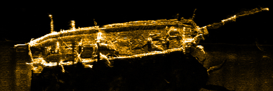  Une image sonographique d'un naufrage.