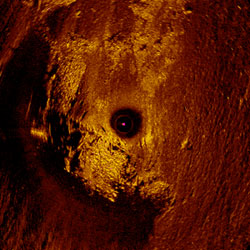 resolution sonar image of the wreck at Pointe à la Batterie